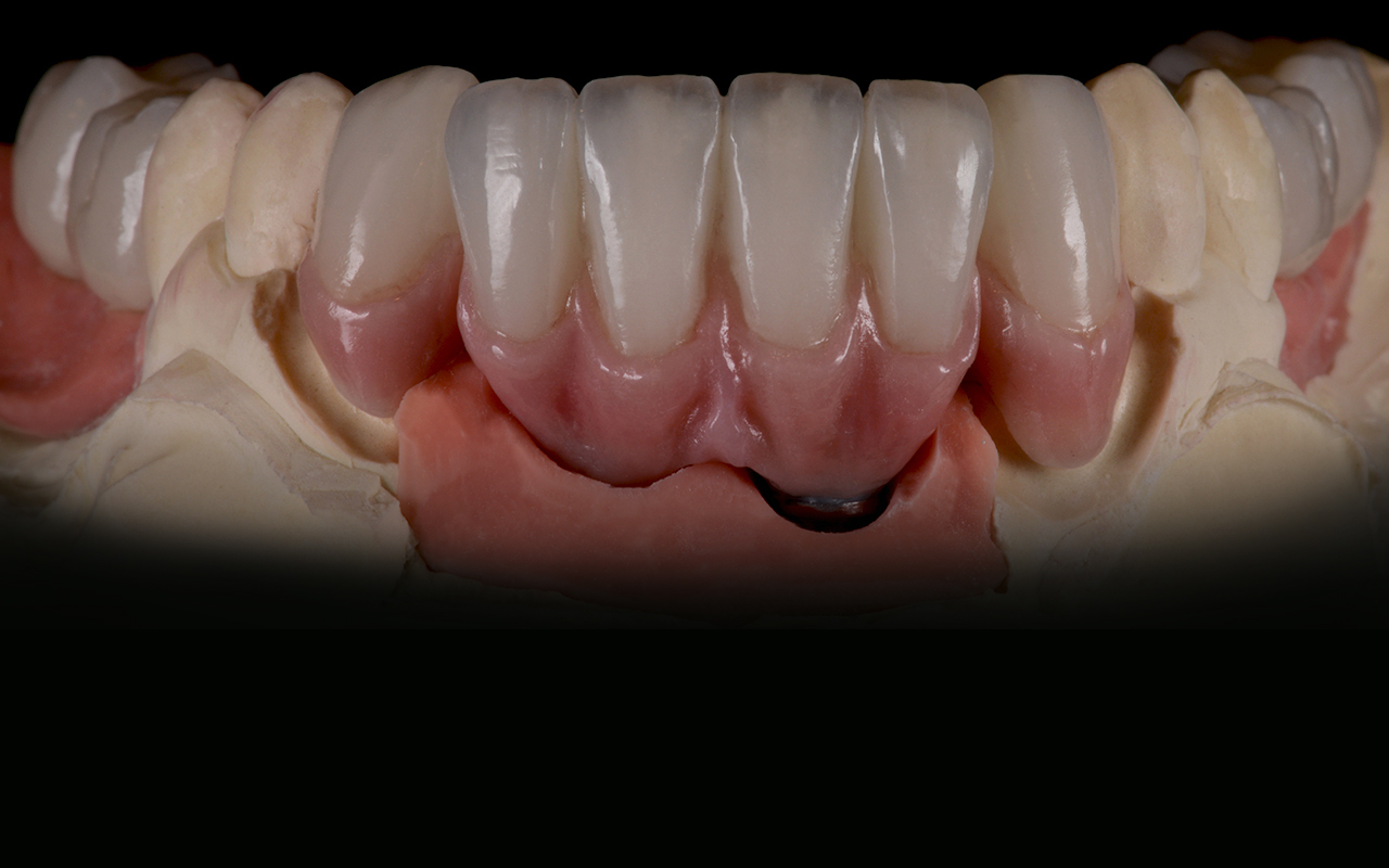 PS Dental Laboratory