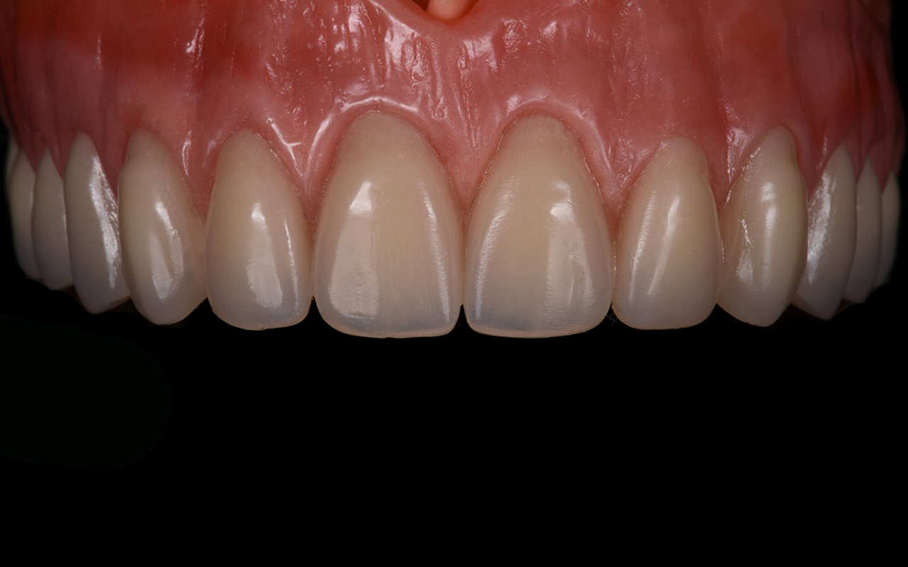 PS Dental Laboratory