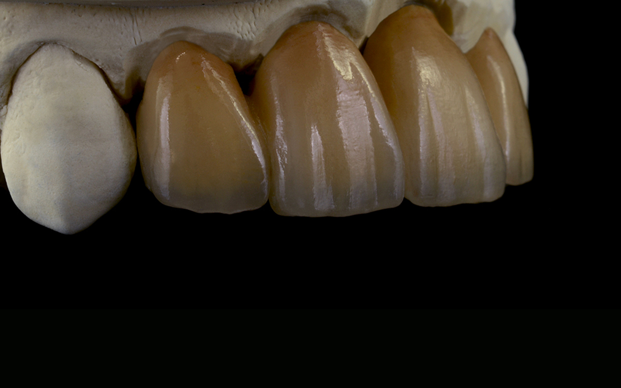 PS Dental Laboratory