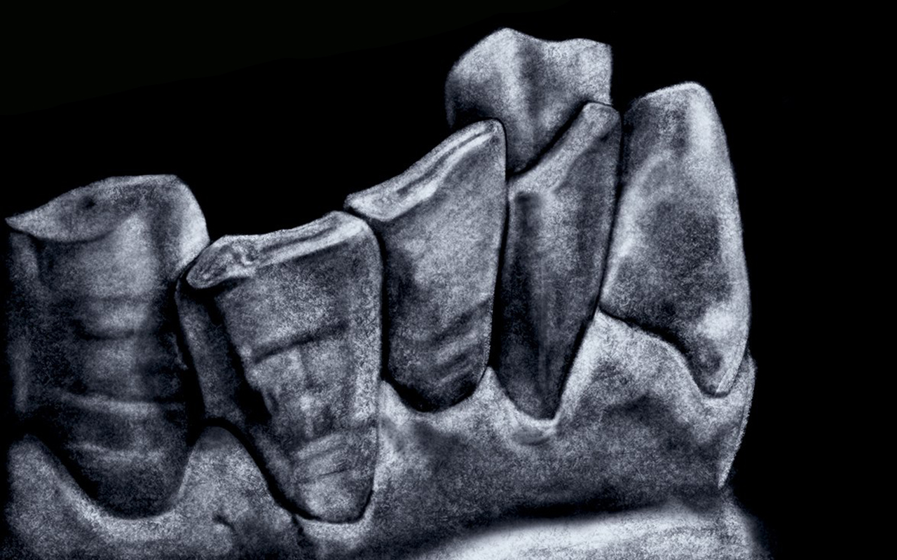 PS Dental Laboratory