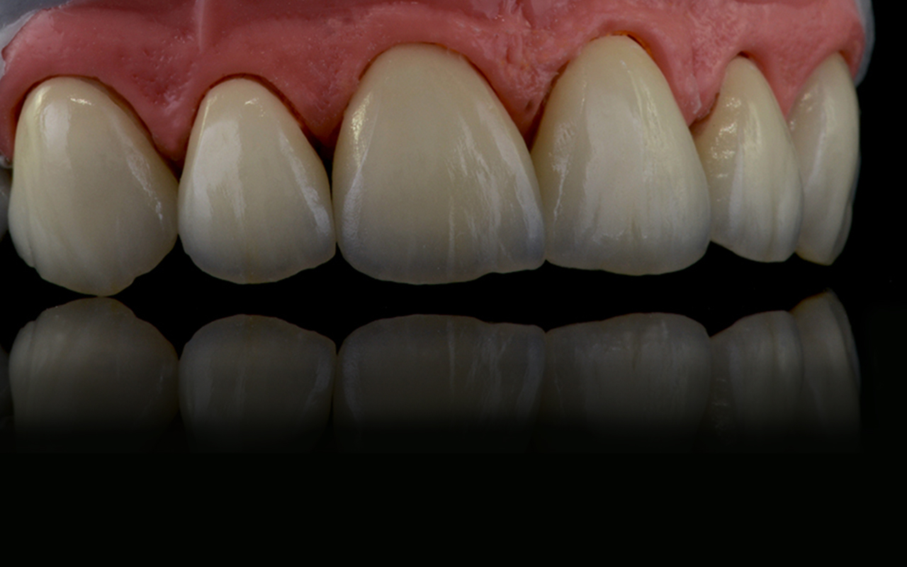PS Dental Laboratory