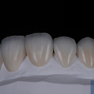 Emax