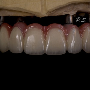 269. ВФ ZrO2
