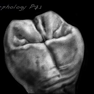 Проект "Shade of morphology"
