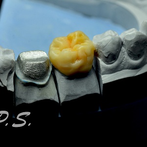 35. Wax Up