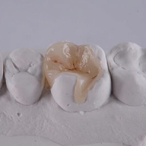 Emax