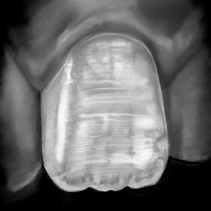 Проект "Shade of morphology"