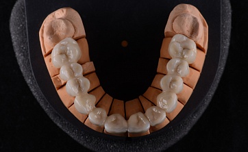 PS Dental Laboratory