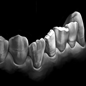 Проект "Shade of morphology"