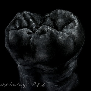 Проект "Shade of morphology"