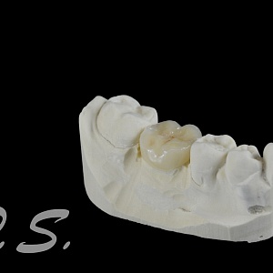 81. E.max
