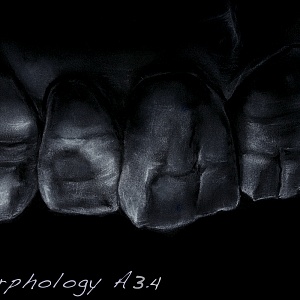 Проект "Shade of morphology"