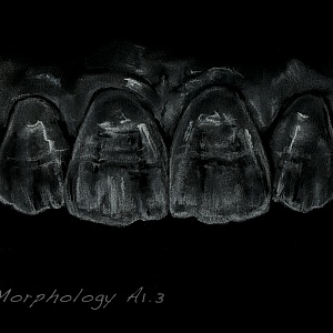 Проект "Shade of morphology"