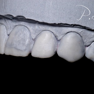 21. Wax Up.