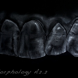Проект "Shade of morphology"
