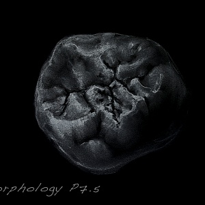 Проект "Shade of morphology"