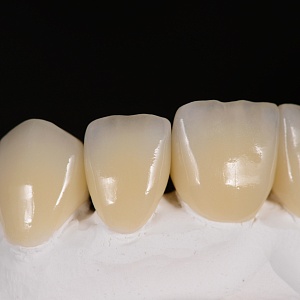 /