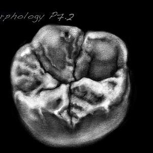 Проект "Shade of morphology"