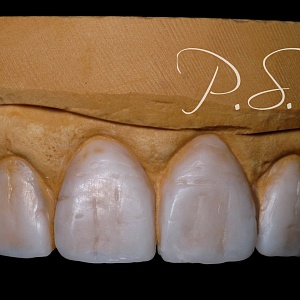 13. E.max.