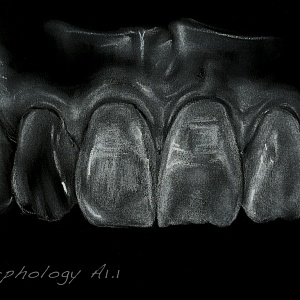 Проект "Shade of morphology"