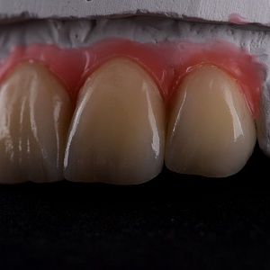 e.max
