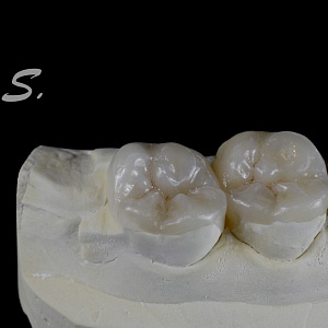 146. E.max