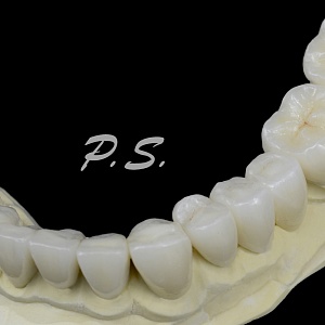 217. ZrO2