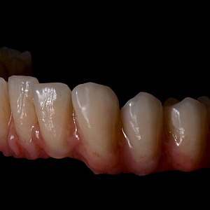 BioHPP