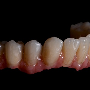 BioHPP