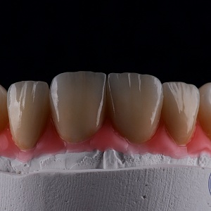 Emax