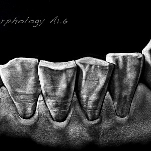 Проект "Shade of morphology"
