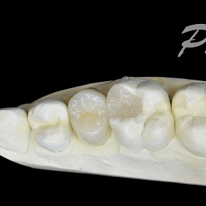 76. Emax