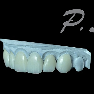 51. E.max